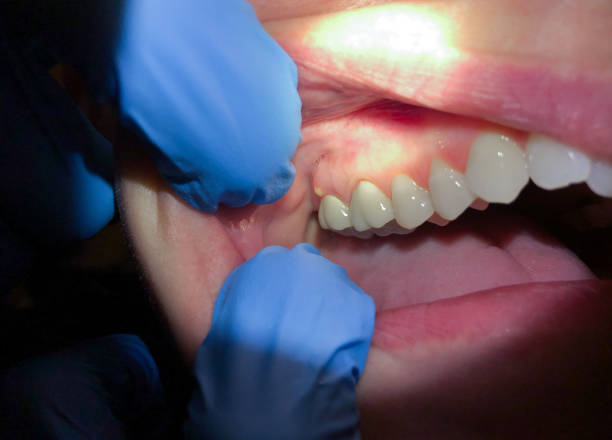 Best Emergency Gum Pain Relief  in Springfield, NJ