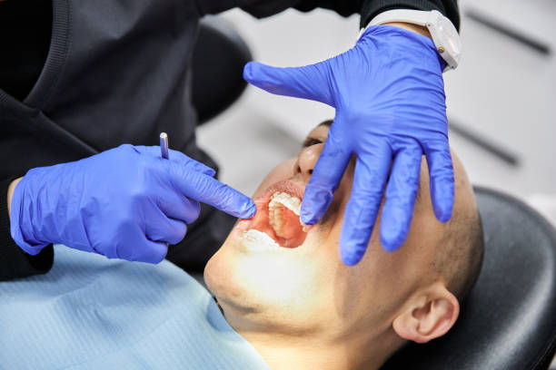 Best Chipped Tooth Repair Near Me  in Springfield, NJ